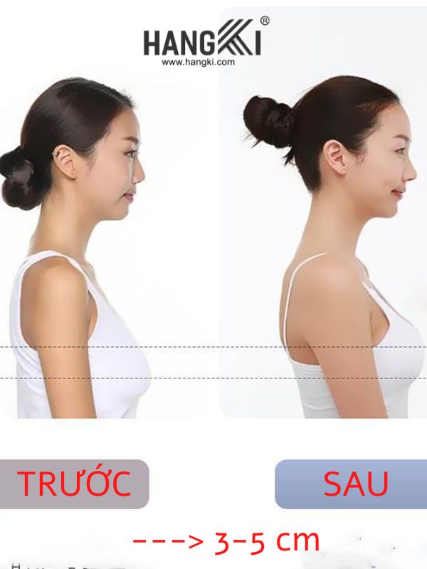 AK14 - Miếng Dán Ngực Silicon Cao Cấp